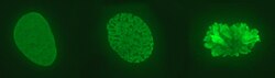 Interphase nucleus (left), condensing chromosomes (middle) and condensed chromosomes (right)