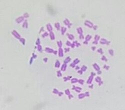 Micrograph of human chromosomes before further processing. Staining with Giemsa confers a purple color to chromosomes, but micrographs are often converted to grayscale to facilitate data presentation and make comparisons of results from different laboratories.[7]