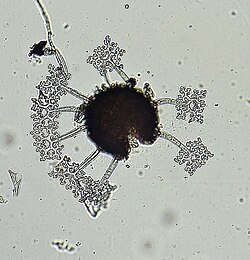 Chasmothecium of Erysiphe abbreviata