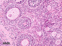 Micrograph of the ovarian cortex from a rhesus monkey showing several round follicles embedded in a matrix of stromal cells. A secondary follicle sectioned through the nucleus of an oocyte is at the upper left, and earlier-stage follicles are at the lower right. The tissue was stained with the dyes hematoxylin and eosin.