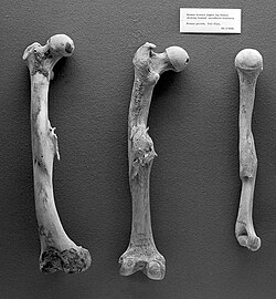 Human femurs and humerus from Roman period, with evidence of healed fractures
