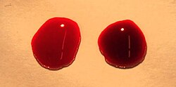 Two drops of blood are shown with a bright red oxygenated drop on the left and a darker red deoxygenated drop on the right.