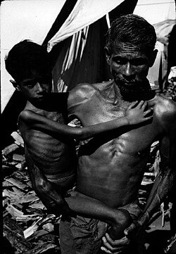 A child suffering extreme starvation in India, 1972