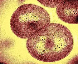 Deinococcus geothermalis, a bacterium that thrives in geothermal springs and deep ocean subsurfaces[100]