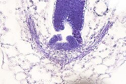 Microscopic image of a shoot apical meristem surrounded by leaf primordia of Arabidopsis thaliana.