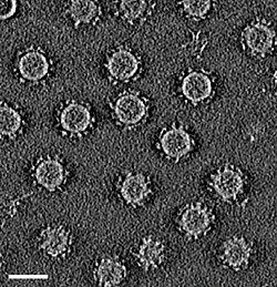 Pleolipoviral virion (HRPV-6)[71]