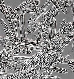Nematocysts from Chironex fleckeri (400x magnification).