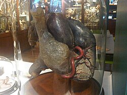 African elephant heart in a jar