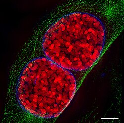 Fluorescence microscope image of two mouse cell nuclei in prophase (scale bar is 5 μm)[31]