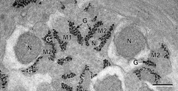 Glycogen (black granules) in spermatozoa of a flatworm; transmission electron microscopy, scale: 0.3 μm