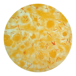 M. tuberculosis (stained red) in sputum