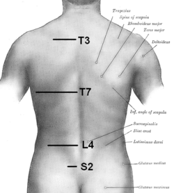 Surface orientation of T3 and T7, at middle of spine of scapula and at inferior angle of the scapula, respectively.