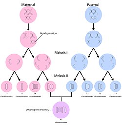 A diagram depicting nondisjunction in the maternal cell during the Meiosis I phase, resulting in gametes with an extra chromosome. Through fertilization of this egg, an offspring with the condition trisomy 21 is produced.