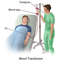 Illustration depicting intravenous blood transfusion