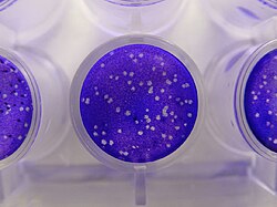 Plaques in cells caused herpes simplex virus. The cells have been fixed and stained blue.