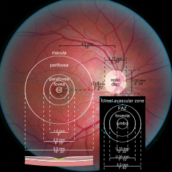 Photograph of the retina of the human eye, with overlay diagrams showing the positions and sizes of the macula, fovea, and optic disc