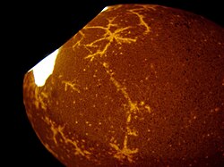 Structure revealed by light