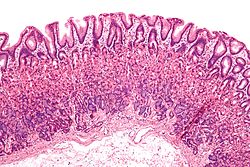 Gastric mucosa at low magnification (H&E stain)