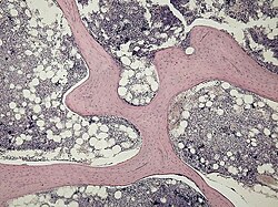 Micrograph of cancellous bone