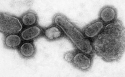 An electron micrograph showing recreated 1918 influenza virions