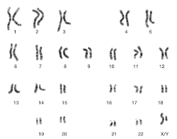 Micrographic karyogram of a human male. See section text for details.