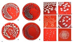 E.coli colonies on agar.