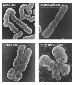 Chromosomes at various stages of mitosis. Karyograms are generally made by chromosomes in prometaphase or metaphase. During these phases, the two copies of each chromosome (connected at the centromere) will look as one unless the image resolution is high enough to distinguish the two.