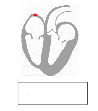 Transmission of a cardiac action potential through the heart's conduction system
