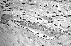 Light micrograph of decalcified cancellous bone tissue displaying osteoblasts actively synthesizing osteoid, containing two osteocytes.