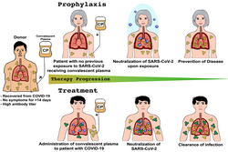 Overview of the application and use of convalescent plasma therapy