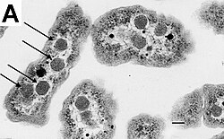 An electron micrograph of Halothiobacillus neapolitanus cells with carboxysomes inside, with arrows highlighting visible carboxysomes. Scale bars indicate 100 nm