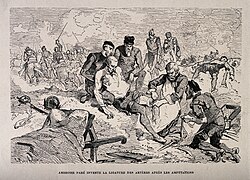 French surgeon Ambroise Paré (c. 1510–1590) – known as the "Father of Military Medicine"[citation needed] – attending to a soldier's amputated leg.