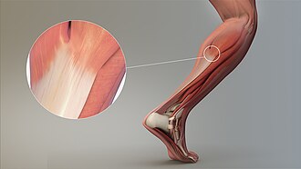 Magnified view of a tendon