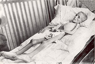 Lizzie van Zyl, a Boer child (age 7), photographed by Emily Hobhouse in a British concentration camp near Bloemfontein, February 1901