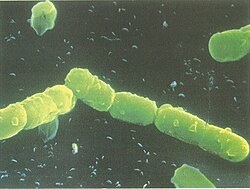 The exterior of Pseudomonas, a genus of Gram-negative Bacteria.