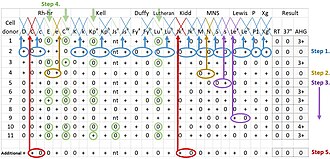 Interpretation of antibody panel to detect patient antibodies towards the most relevant human blood group systems
