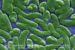 Vibrio vulnificus, a virulent bacterium found in estuaries and along coastal areas