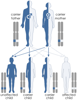 Illustration of autosomal recessive inheritance. Each parent has one blue allele and one white allele. Each of their 4 children inherit one allele from each parent such that one child ends up with two blue alleles, one child has two white alleles and two children have one of each allele. Only the child with both blue alleles shows the trait because the trait is recessive.