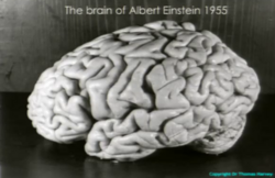 Einstein's brain was preserved after his death in 1955, but this fact was not revealed until 1978.