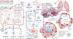 COVID‑19 pathogenesis