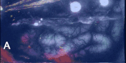 Example of biological waves expanding over the brain cortex, an example of spreading depolarizations[3]