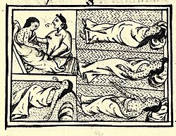 Depiction of smallpox in Book XII of the 16th-century Florentine Codex (compiled 1540–1585) in conquest-era central Mexico suffering from smallpox